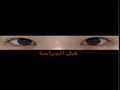 المدير الطبي دو أون روك - تجربة جراحة الجفن المزدوج بالشق