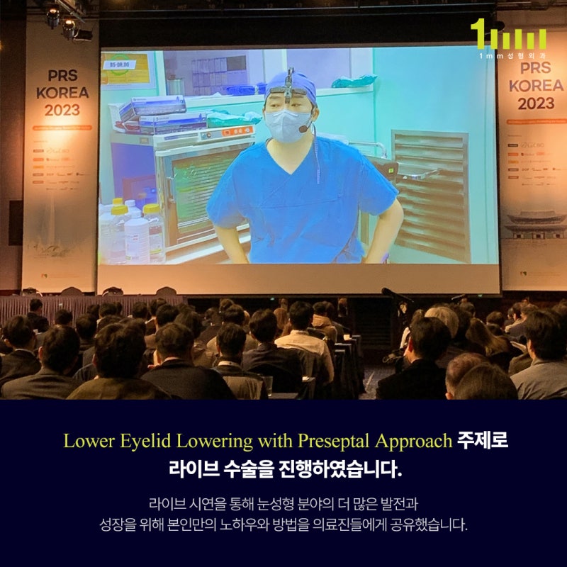 1mm جراحة التجميل: المدير الطبي دو أون روك يجري عملية جراحية مباشرة في PRS KOREA، صورة 2