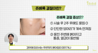 ما هي طرق الوقاية من عقيدات JUVÉLOOK؟ 1mm جراحة التجميل صورة 4
