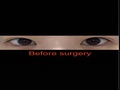 Director Do Eon-rok - Double Incision Review