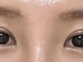 Ulasan sutradara Kim Hong-jin (adhesi alami + bibir atas)