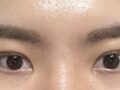 การยึดเกาะตามธรรมชาติ