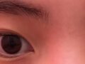 การยึดเกาะตามธรรมชาติ