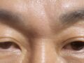 男の二重まぶたのレビュー