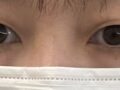 日ミリ整形外科キム・ホンジン院長自然癒着