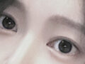 รีวิวการยกกระชับเปลือกตาบนด้วยวิธี Natural Adhesion หลังใช้ 2 เดือน