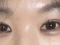 บทวิจารณ์การผ่าตัดทำตาสองชั้นของผู้กำกับโด ออน-ร็อก