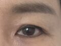 ผู้กำกับ โด ออน-รก (ศัลยกรรมตาในวัยกลางคน)