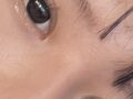 รีวิวการผ่าตัดตาของ ดร.โด ออน-รก (การผ่าตัด + การแก้ไขเปลือกตา + การยกเปลือกตาบน)