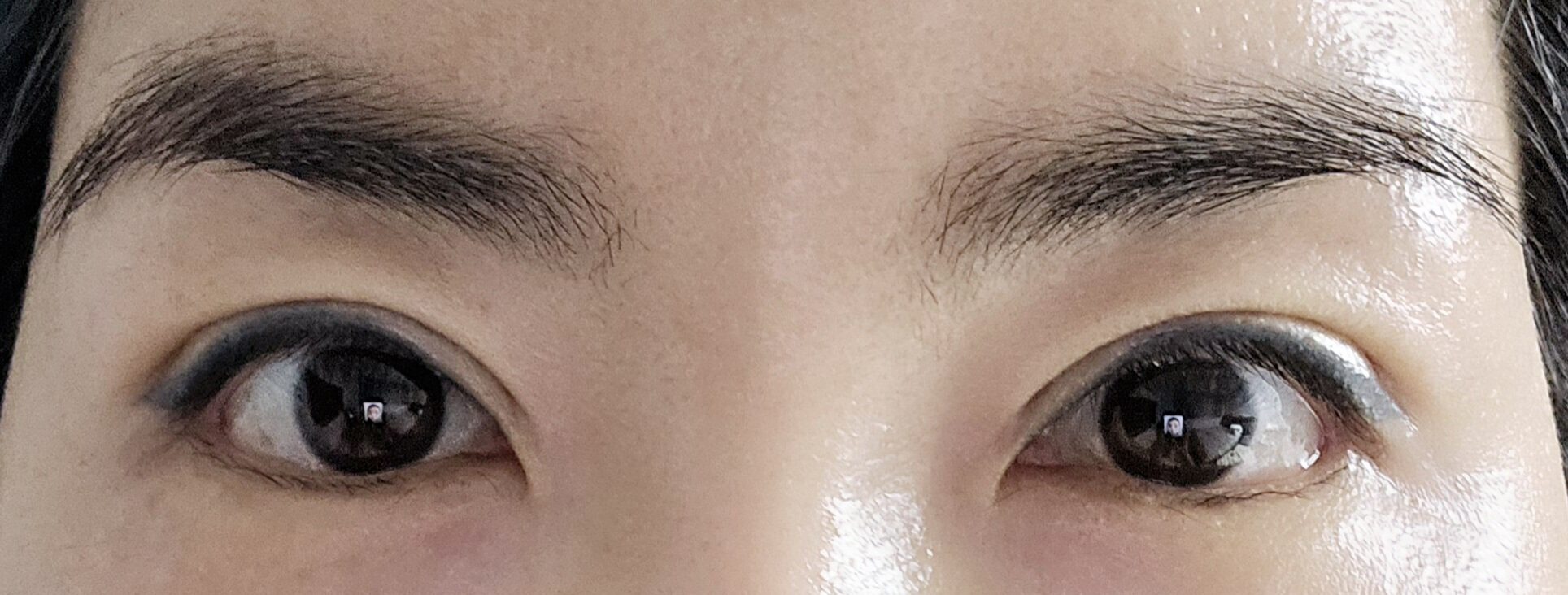 术后一个月