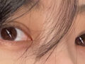รีวิวหลังผ่าตัดทำตาสองชั้น 2 เดือน โดยคุณหมอโด ออน-ร็อก ที่คลินิกอิลมิริ