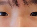 ศัลยกรรมตกแต่งตาสองชั้น Ilmiri Plastic Surgery (ผู้กำกับ Do Eon-rok)