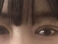 道言録院長の雪再手術のレビュー！