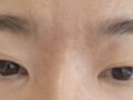 道言録院長切開再手術のレビュー