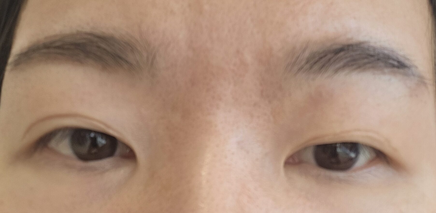 道言録院長切開再手術のレビュー
