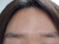ナ・ヨンス元帳自然癒着