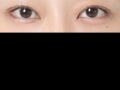 รีวิวการผ่าตัดทำตาสองชั้นของ ดร.โด ออน-ร็อก