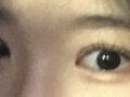 บทวิจารณ์การผ่าตัดทำตาสองชั้นของผู้กำกับโด ออน-ร็อก