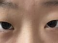 คลินิกศัลยกรรมพลาสติกอิลมิริ ผู้อำนวยการ คิม ฮงจิน