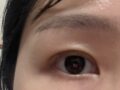 キム・ホンジン先生自然癒着6週目のレビュー