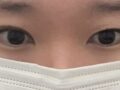 キム・ホンジン院長に手術を受けました