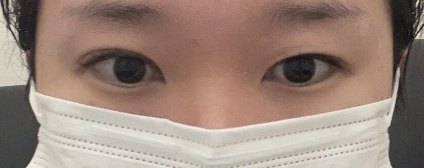 キム・ホンジン院長に手術を受けました