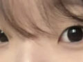 ศัลยกรรมตกแต่งเปลือกตาสองชั้น