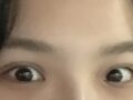 การยึดเกาะตามธรรมชาติ 1 มม.