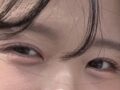 การยึดเกาะตามธรรมชาติ 1 มม.