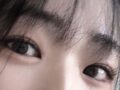 นี่คือรีวิวการผ่าตัดทำตาสองชั้นของฉัน!! (ผ่าตัดทำตาสองชั้น + ยกกระชับเปลือกตาบน)