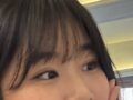 イルミリー非切開ペアのレビュー