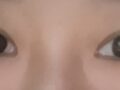 นี่คือรีวิวเกี่ยวกับการผ่าตัดแผลเปิดและรอยต่อที่ฉันได้รับจากผู้กำกับโด ออน-รก!