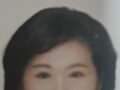 双眼皮手术反馈