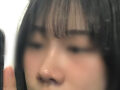 鼻整形の後期です🐽