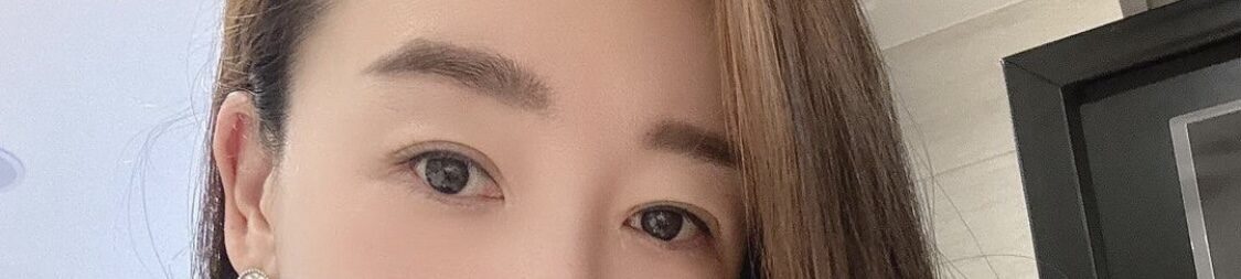 双眼皮修复  术后一个月 反馈