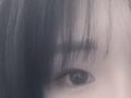 金洪振院长自然粘连  术后反馈