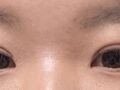 รีวิวการผ่าตัดของดร.โด