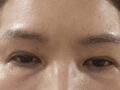รีวิวการยกคิ้ว
