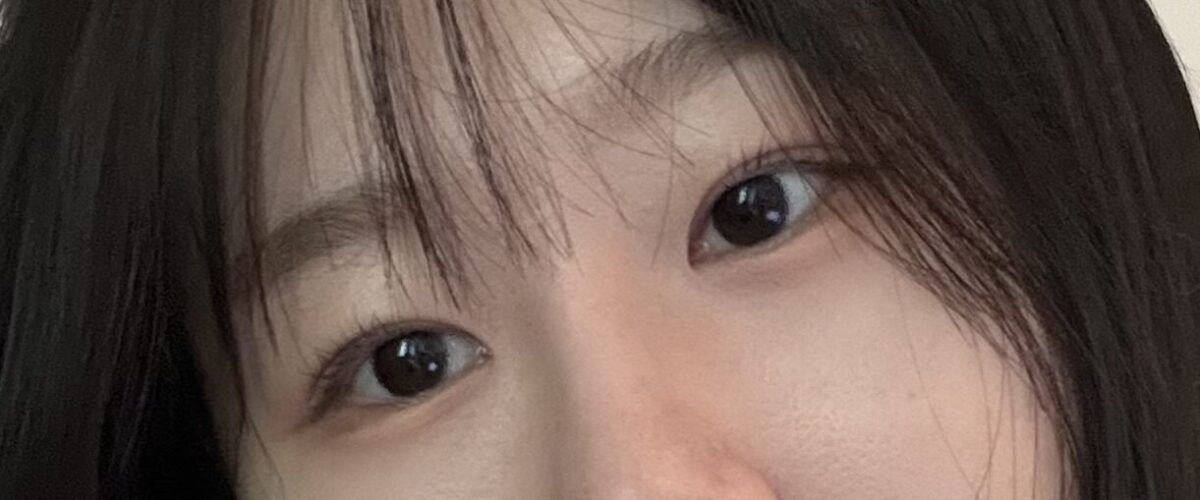 金洪振院长  自然粘连 术后反馈