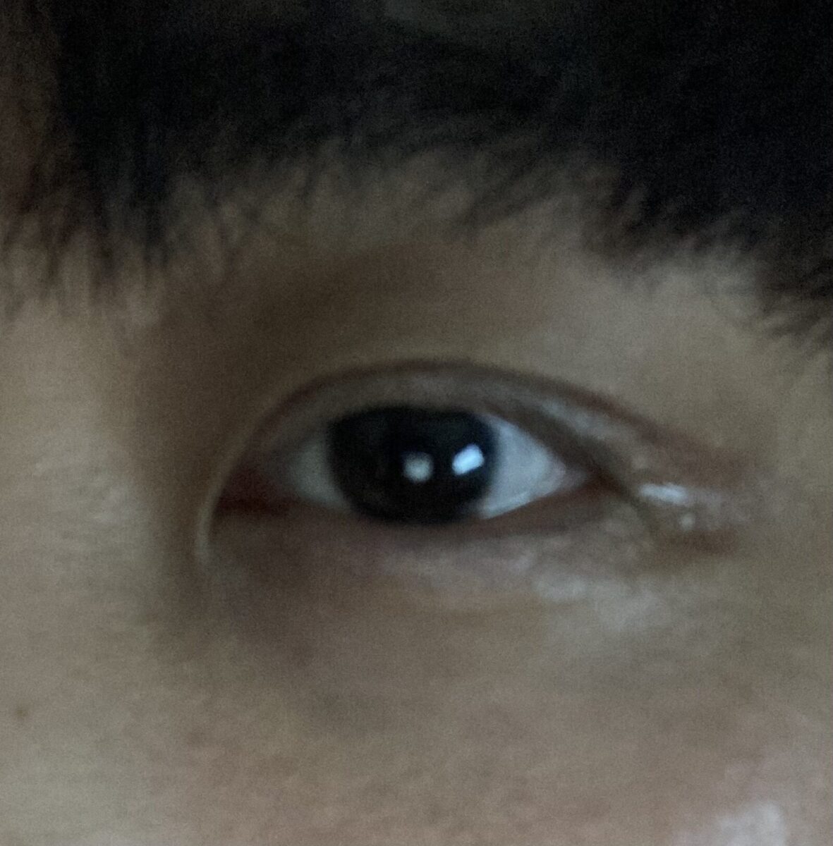 都彦禄院长 术后反馈