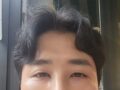 都彦禄院长  术后反馈