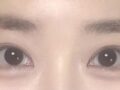 บทวิจารณ์การผ่าตัดทำตาสองชั้นของผู้กำกับโด ออน-ร็อก