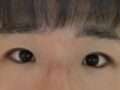 ศัลยกรรมตาชายของผู้อำนวยการใหญ่ โด ออน-ร็อก