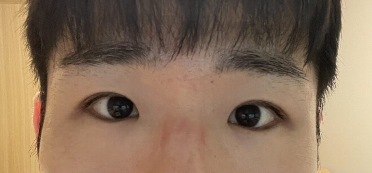 ドアンロック代表院長男目整形