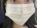 都彦禄院长  双眼皮修复 术后反馈