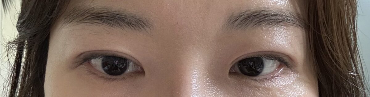 院長切開再手術のレビュー