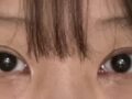 キム・ホンジン院長双ペル再手術