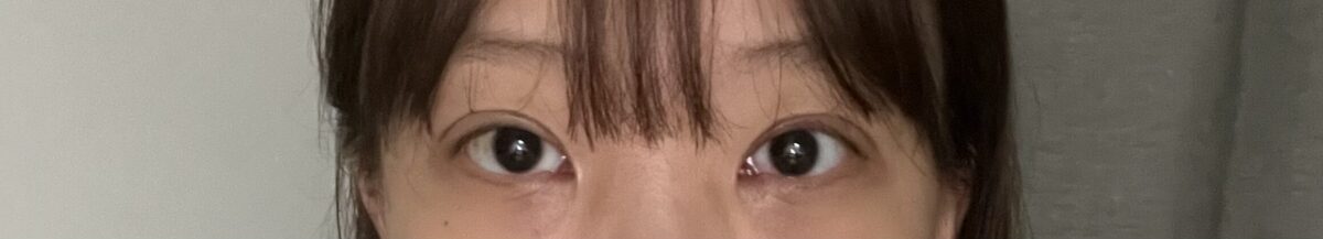 キム・ホンジン院長双ペル再手術