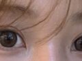 自然癒着のレビュー