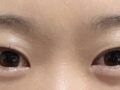 รีวิวการผ่าตัดของ ดร. นา ยองซู
